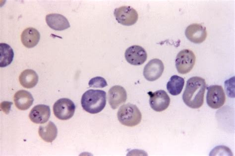  Babesia Uma Protozoária Parasita Que Causa Babesiose em Vertebrados de Sangue Quente!