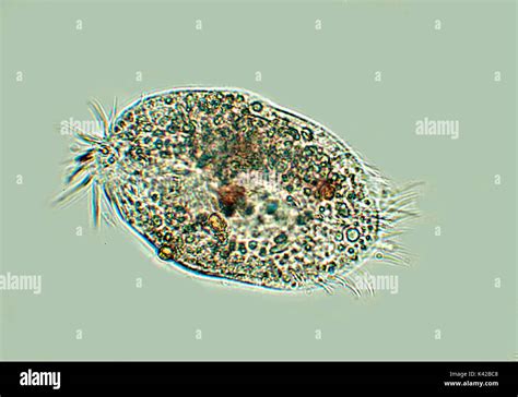  Lophomonas! Uma Cilia Encantadora que Vive em Águas Doçes e Traz Mistérios Microscópicos