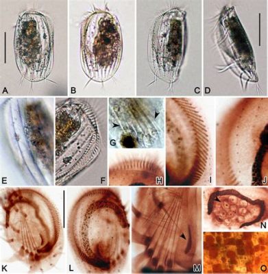 Woollsia: Desvendando o Misterioso Estilo de Vida deste Ciliophora em Forma de Grão de Arroz!